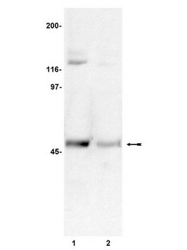 Anti-phospho-CaM Kinase II Antibody, &#945; subunit, (Thr286), clone 22B1 clone 22B1, Upstate&#174;, from mouse