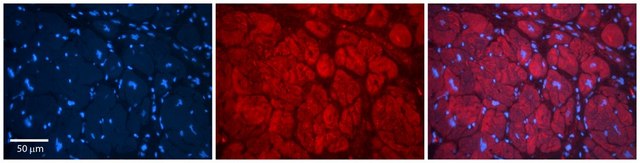 Anti-TMED1 antibody produced in rabbit affinity isolated antibody