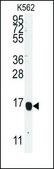 Anti-ALOX5AP (center) antibody produced in rabbit saturated ammonium sulfate (SAS) precipitated, buffered aqueous solution