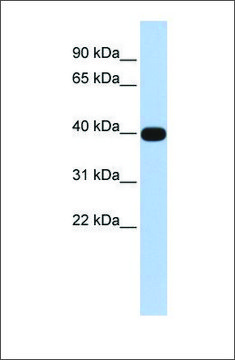 Anti-LMX1A antibody produced in rabbit affinity isolated antibody