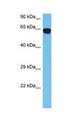 Anti-CRMP1 (AB1) antibody produced in rabbit affinity isolated antibody