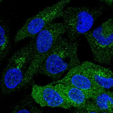 Anti-PKLR antibody produced in rabbit Prestige Antibodies&#174; Powered by Atlas Antibodies, affinity isolated antibody