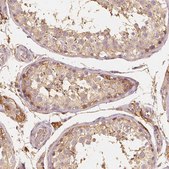 Anti-ARHGAP26 antibody produced in rabbit Prestige Antibodies® Powered by Atlas Antibodies, affinity isolated antibody, buffered aqueous glycerol solution