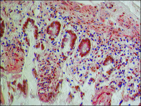 抗-PKM2 （亚型 M1） 兔抗 ~1.5&#160;mg/mL, affinity isolated antibody