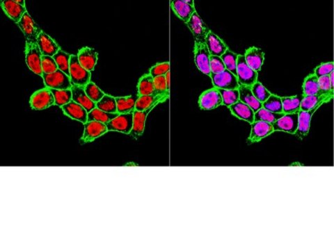 Anti-SRF [Serum Response Factor] Antibody, clone 1E1 clone 1E1, from mouse