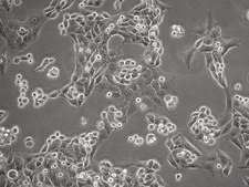 HCC95 Human Lung Squamous Carcinoma Cell Line