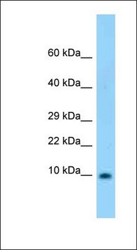 抗-S100B 兔抗 affinity isolated antibody