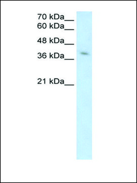 Anti-MICA antibody produced in rabbit IgG fraction of antiserum