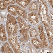Anti-CFI antibody produced in rabbit Prestige Antibodies® Powered by Atlas Antibodies, affinity isolated antibody, buffered aqueous glycerol solution