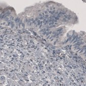 Monoclonal Anti-PGM1 antibody produced in mouse Prestige Antibodies® Powered by Atlas Antibodies, clone CL3301, purified immunoglobulin