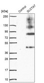 Anti-SLC7A7 antibody produced in rabbit Prestige Antibodies® Powered by Atlas Antibodies, affinity isolated antibody, buffered aqueous glycerol solution
