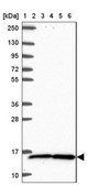Anti-TAX1BP3 antibody produced in rabbit Prestige Antibodies® Powered by Atlas Antibodies, affinity isolated antibody, buffered aqueous glycerol solution