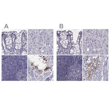 Anti-FAM71B antibody produced in rabbit Prestige Antibodies&#174; Powered by Atlas Antibodies, affinity isolated antibody, buffered aqueous glycerol solution