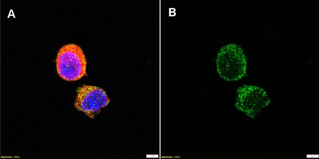 Anti-CCR6/CD196 Antibody, clone 1K9 ZooMAb&#174; Rabbit Monoclonal recombinant, expressed in HEK 293 cells