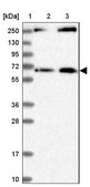 Anti-MDM1 antibody produced in rabbit Prestige Antibodies® Powered by Atlas Antibodies, affinity isolated antibody, buffered aqueous glycerol solution
