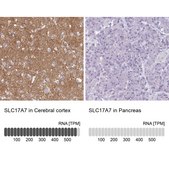 Anti-SLC17A7 antibody produced in rabbit Prestige Antibodies® Powered by Atlas Antibodies, affinity isolated antibody, buffered aqueous glycerol solution