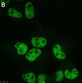 Anti-VGLL4 Antibody, clone 1K23 ZooMAb® Rabbit Monoclonal recombinant, expressed in HEK 293 cells