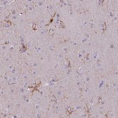 Monoclonal Anti-ITGAM antibody produced in mouse Prestige Antibodies® Powered by Atlas Antibodies, clone CL1719, purified immunoglobulin, buffered aqueous glycerol solution