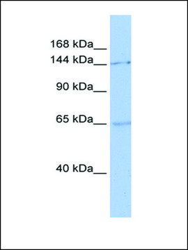 Anti-SMC1A antibody produced in rabbit affinity isolated antibody