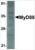 Monoclonal Anti-MyD88 antibody produced in mouse clone 2E9C2, purified immunoglobulin, buffered aqueous solution