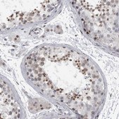 Anti-EVI5 antibody produced in rabbit Prestige Antibodies® Powered by Atlas Antibodies, affinity isolated antibody, buffered aqueous glycerol solution