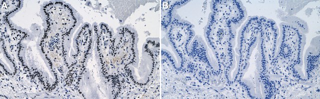 Anti-CBX5 Antibody, clone 5I2-K ZooMAb&#174; Rabbit Monoclonal recombinant, expressed in HEK 293 cells