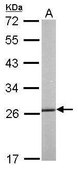 Anti-HSPB1 antibody produced in rabbit