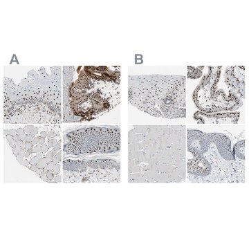 抗-GRHL1 兔抗 Ab1, Prestige Antibodies&#174; Powered by Atlas Antibodies, affinity isolated antibody, buffered aqueous glycerol solution