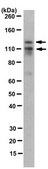 Anti-RA-induced protein 17 Antibody, clone 5H5.1 clone 5H5.1, from mouse