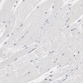 Anti-GPR143 antibody produced in rabbit Prestige Antibodies® Powered by Atlas Antibodies, affinity isolated antibody, buffered aqueous glycerol solution