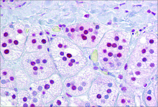 Anti-RORA (ab3) antibody produced in rabbit affinity isolated antibody