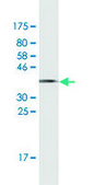Monoclonal Anti-RPS19 antibody produced in mouse clone 3C6, ascites fluid