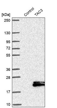 Anti-TAC3 antibody produced in rabbit Prestige Antibodies&#174; Powered by Atlas Antibodies, affinity isolated antibody, buffered aqueous glycerol solution