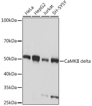 Anti-CaMKII delta Antibody, clone 10M1P2, Rabbit Monoclonal