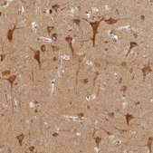 Anti-ARFGEF1 antibody produced in rabbit Prestige Antibodies® Powered by Atlas Antibodies, affinity isolated antibody, buffered aqueous glycerol solution, Ab2