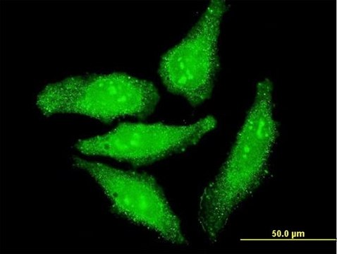 ANTI-OTX1 antibody produced in mouse clone 3A5, purified immunoglobulin, buffered aqueous solution