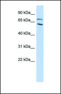 Anti-MTA2, (N-terminal) antibody produced in rabbit affinity isolated antibody