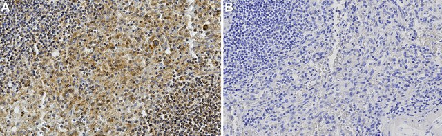 Anti-FasL/CD178 Antibody, clone 2O22 ZooMAb&#174; Rabbit Monoclonal recombinant, expressed in HEK 293 cells