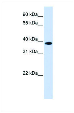 Anti-GPD1L antibody produced in rabbit affinity isolated antibody