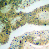 Anti-phospho-p70 S6 Kinase (pSer418) antibody produced in rabbit affinity isolated antibody
