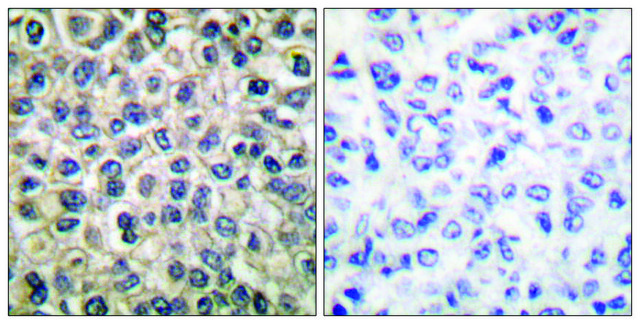 Anti-Catenin-&#947; antibody produced in rabbit affinity isolated antibody