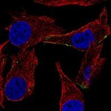 Anti-DCT antibody produced in rabbit Prestige Antibodies&#174; Powered by Atlas Antibodies, affinity isolated antibody, buffered aqueous glycerol solution