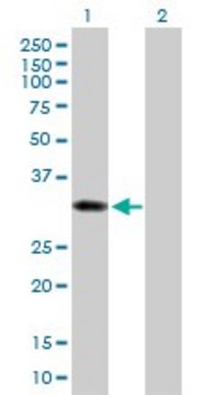 Anti-SULT1B1 antibody produced in mouse IgG fraction of antiserum, buffered aqueous solution