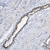 Anti-ACKR1 antibody produced in rabbit Prestige Antibodies® Powered by Atlas Antibodies, affinity isolated antibody, buffered aqueous glycerol solution