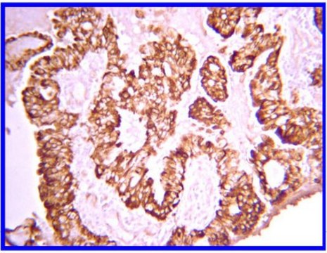 Anti-PDGF-AA Antibody from rabbit, purified by affinity chromatography