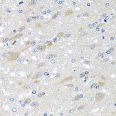 Anti-NDUFS3 antibody produced in rabbit
