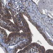 Anti-PTGER4 antibody produced in rabbit Prestige Antibodies® Powered by Atlas Antibodies, affinity isolated antibody, buffered aqueous glycerol solution