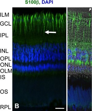 Monoclonal Anti-S-100 (&#946;-Subunit) antibody produced in mouse clone SH-B1, ascites fluid