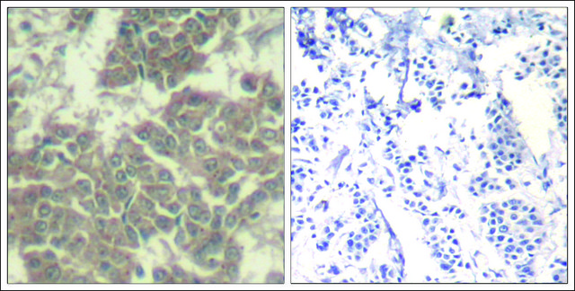 Anti-JAK2 (Ab-570) antibody produced in rabbit affinity isolated antibody