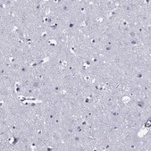 Anti-IKZF3 antibody produced in rabbit Prestige Antibodies® Powered by Atlas Antibodies, affinity isolated antibody, buffered aqueous glycerol solution